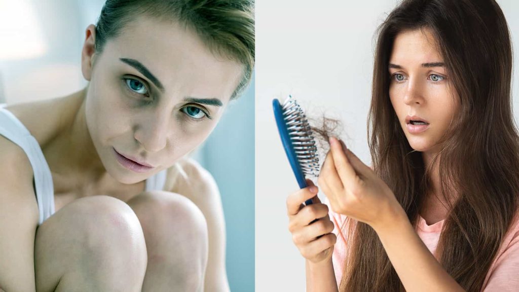 pallore e perdita di capelli sono due sintomi di anemia