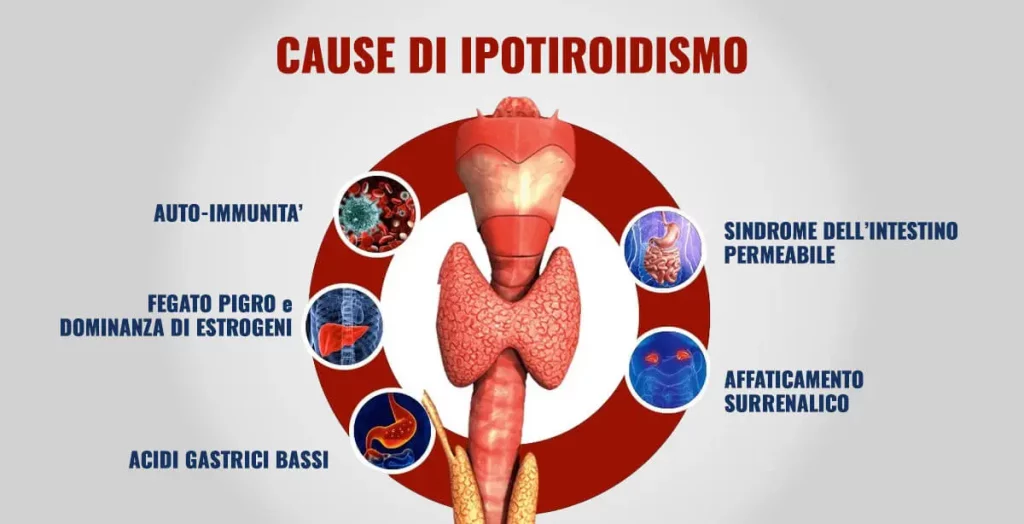 IPOTIROIDISMO CAUSE