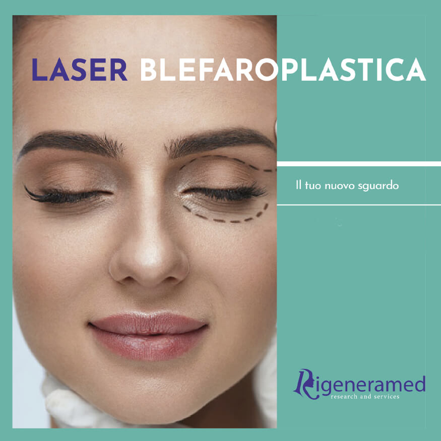 laser blefaroplastica trattamenti di medicina estetica Biomedic Clinic & Research