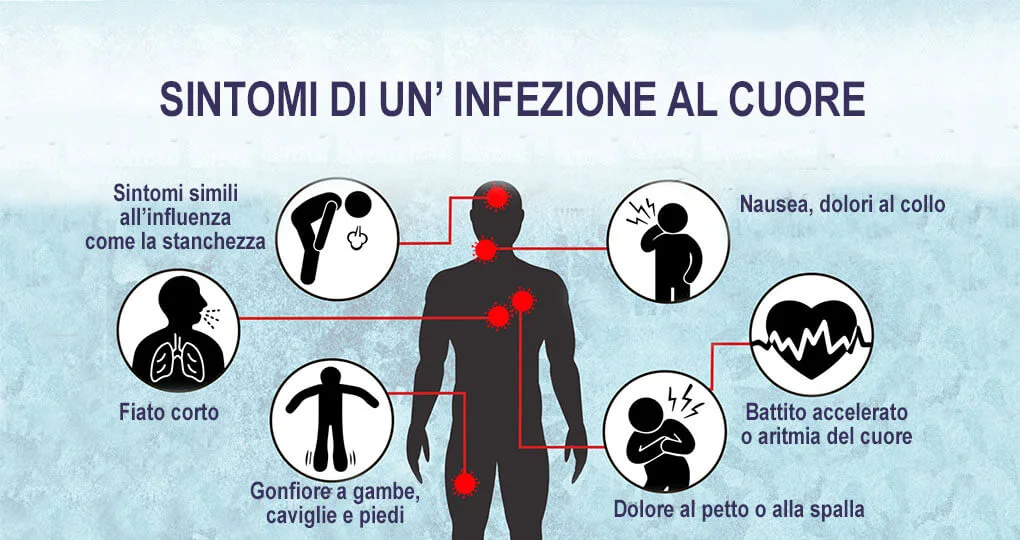 pericardite e miocardite: sintomi di un'infezione al cuore