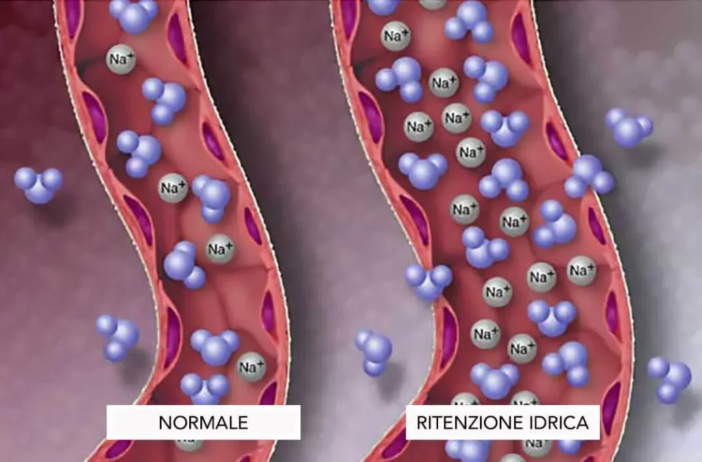 ritenzione idrica aumento di sodio