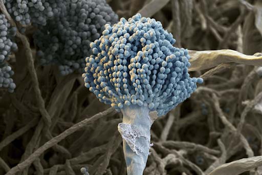 ASPERGILLOSI - infezione da aspergillus