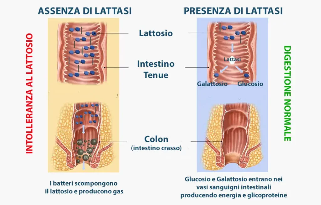 intolleranza al lattosio: il ruolo della lattasi