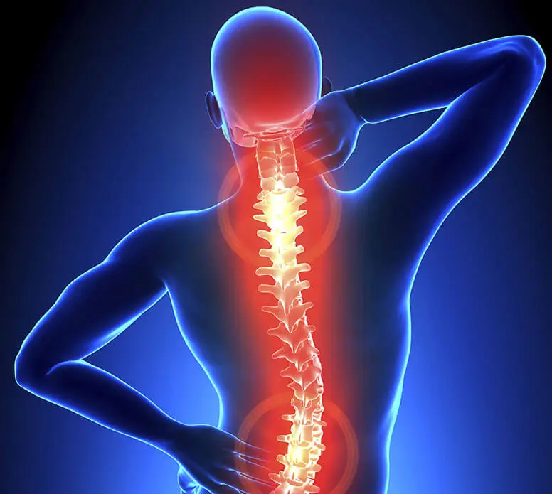 mal di schiena: sintomi, cause, trattamenti