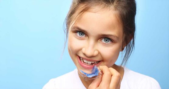Con l'ortodonzia intercettiva è possibile “intercettare” malocclusioni in giovane età. Apparecchio ortodontico