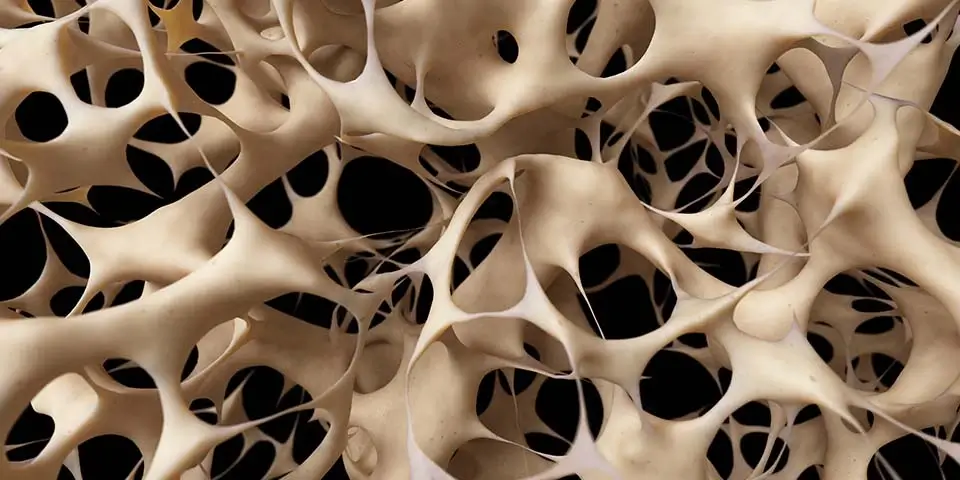 osteoporosi - cellule dell'osso