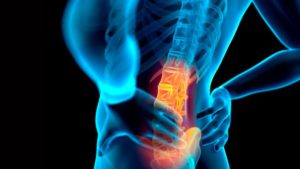 il mal di schiena lombare è principalmente dovuto ad una postura scorretta