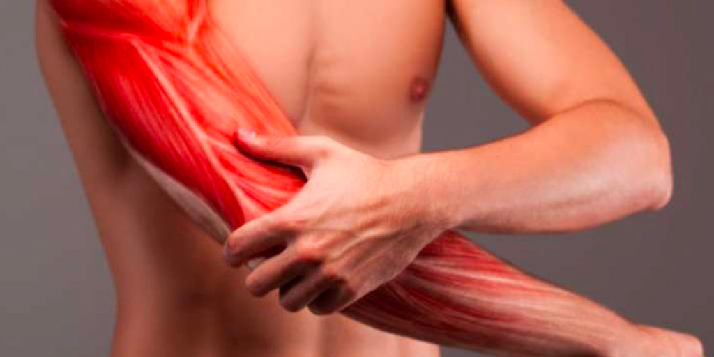 I dolori muscolari (mialgia) sono estremamente comuni. Dal momento che il tessuto muscolare è presente in quasi tutte le parti del corpo, questo tipo di dolore può essere sentito praticamente ovunque. Tuttavia, non esiste un'unica causa per i dolori muscolari.