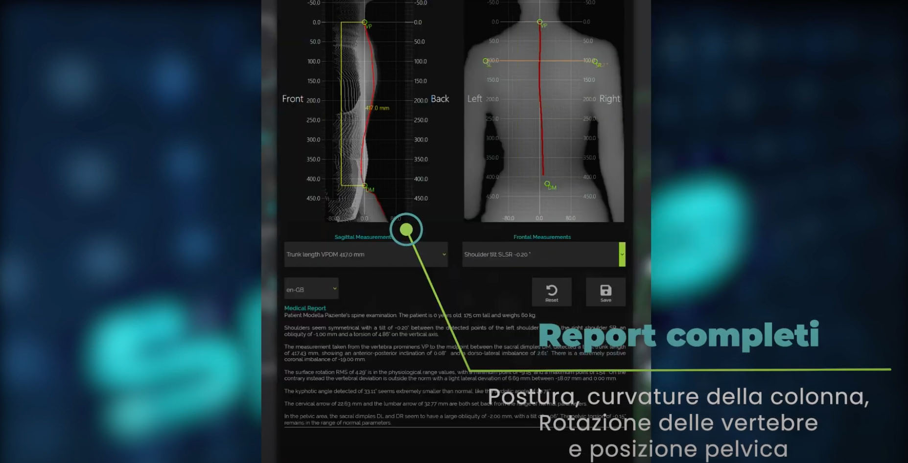 valutazione posturale, delle curvature della colonna, rotazione delle vertebre e posizione pelvica