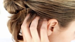 Differenze tra dermatite seborroica e psoriasi del cuoio capelluto