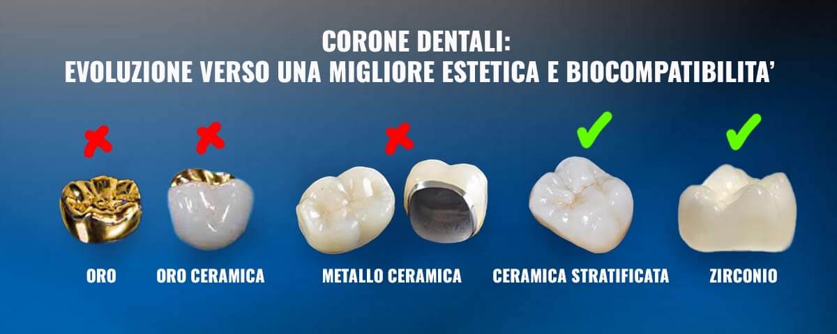 corone dentali metal free