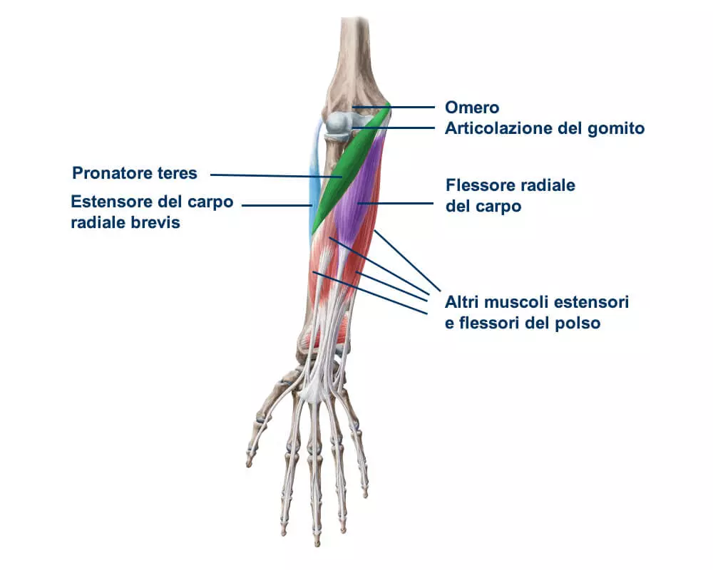 epicondilite muscoli interessati