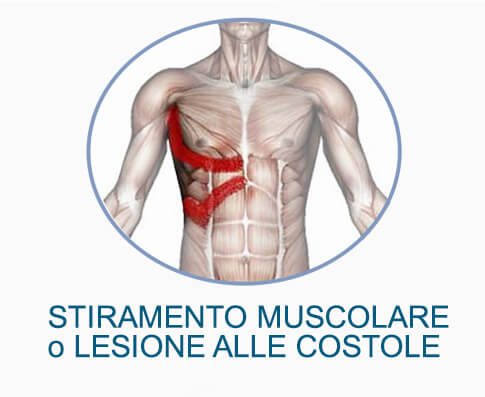 Il dolore al petto può essere causato da uno stiramento muscolare