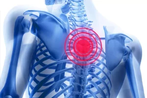 possibili cause del dolore alla parte alta della schiena