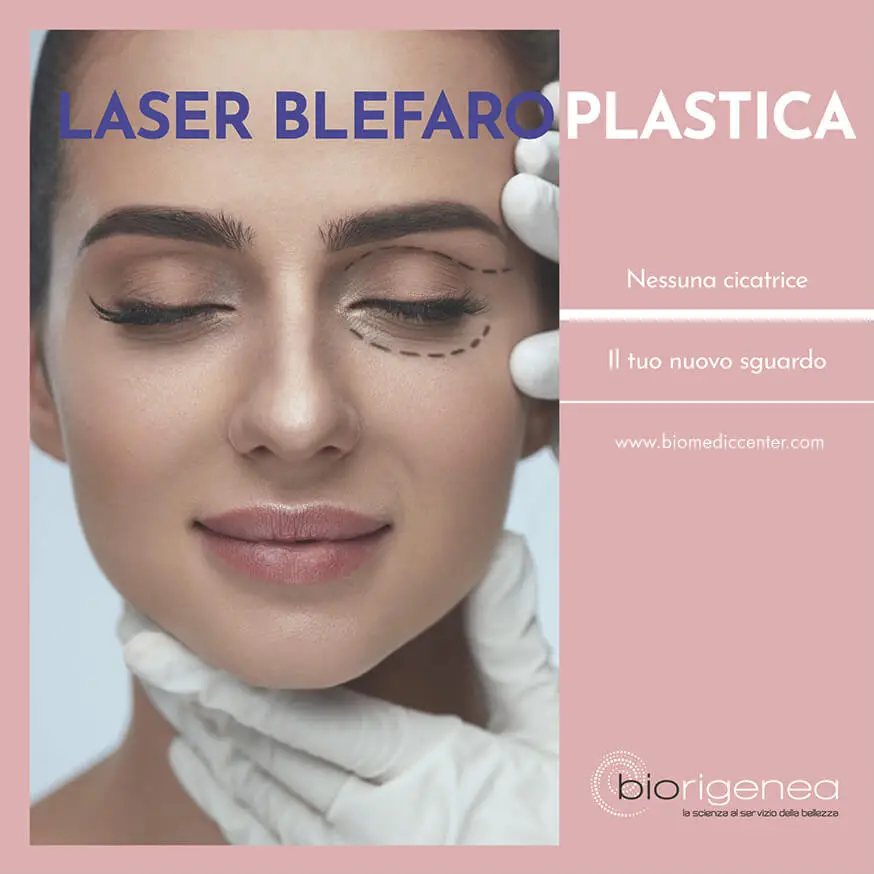 laser blefaroplastica (migliorare le palpebre senza chirurgia)
