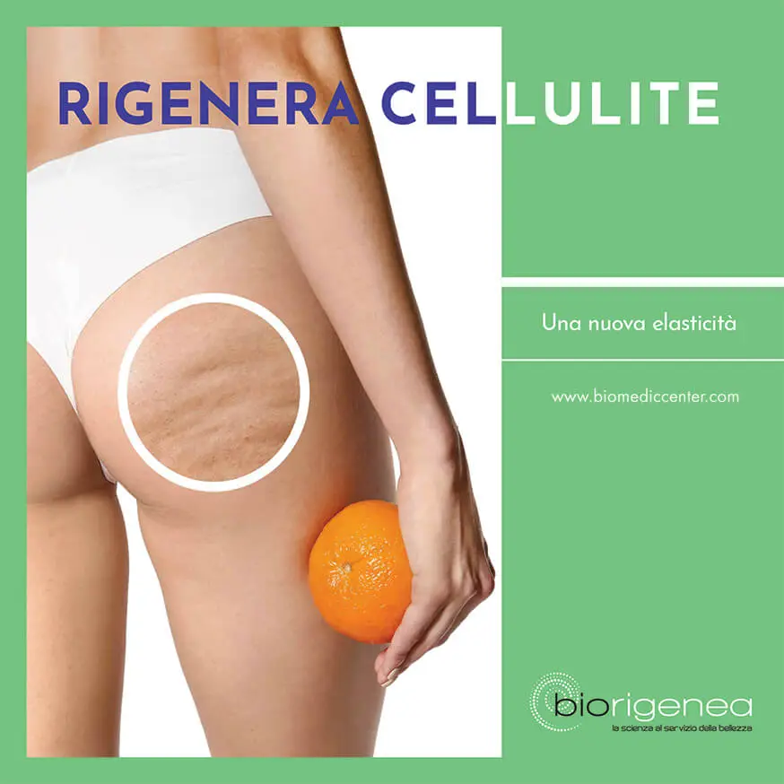 trattamento della cellulite con la medicina estetica rigenerativa