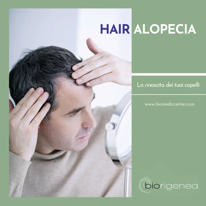 trattamento della calvizie hair alopecia