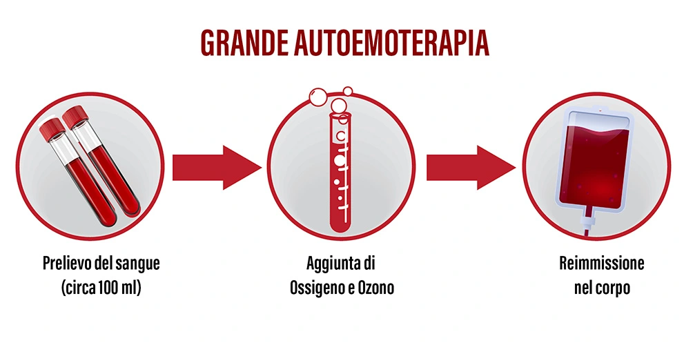 Grande Autoemoterapia come funziona